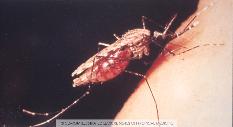 Malaria is transmitted via the bite of infected female Anopheles mosquitoes.